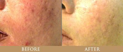 Dr. Gregory Chernoff Before and After