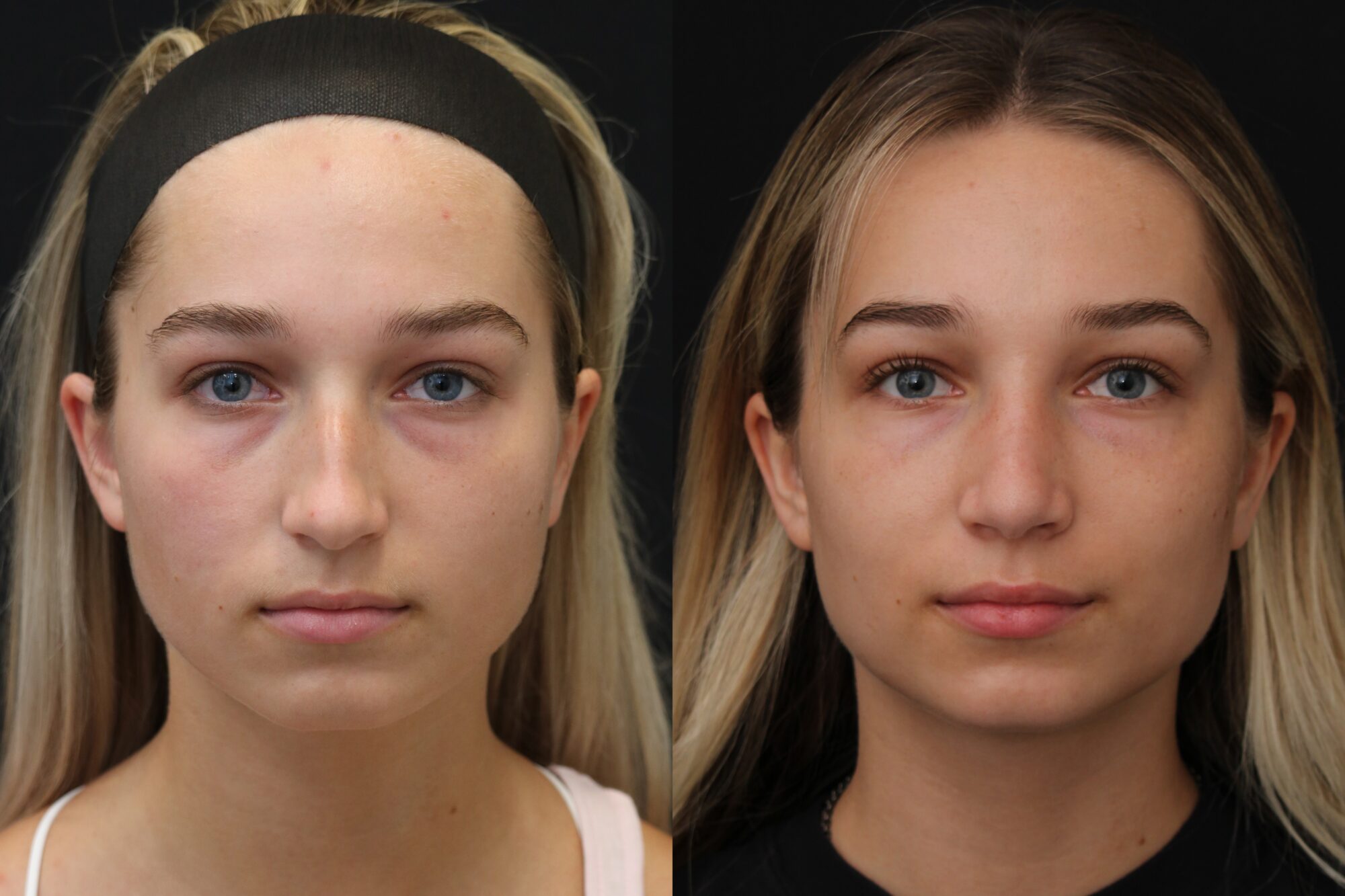 financing options sheet for Indianapolis plastic surgery cost
