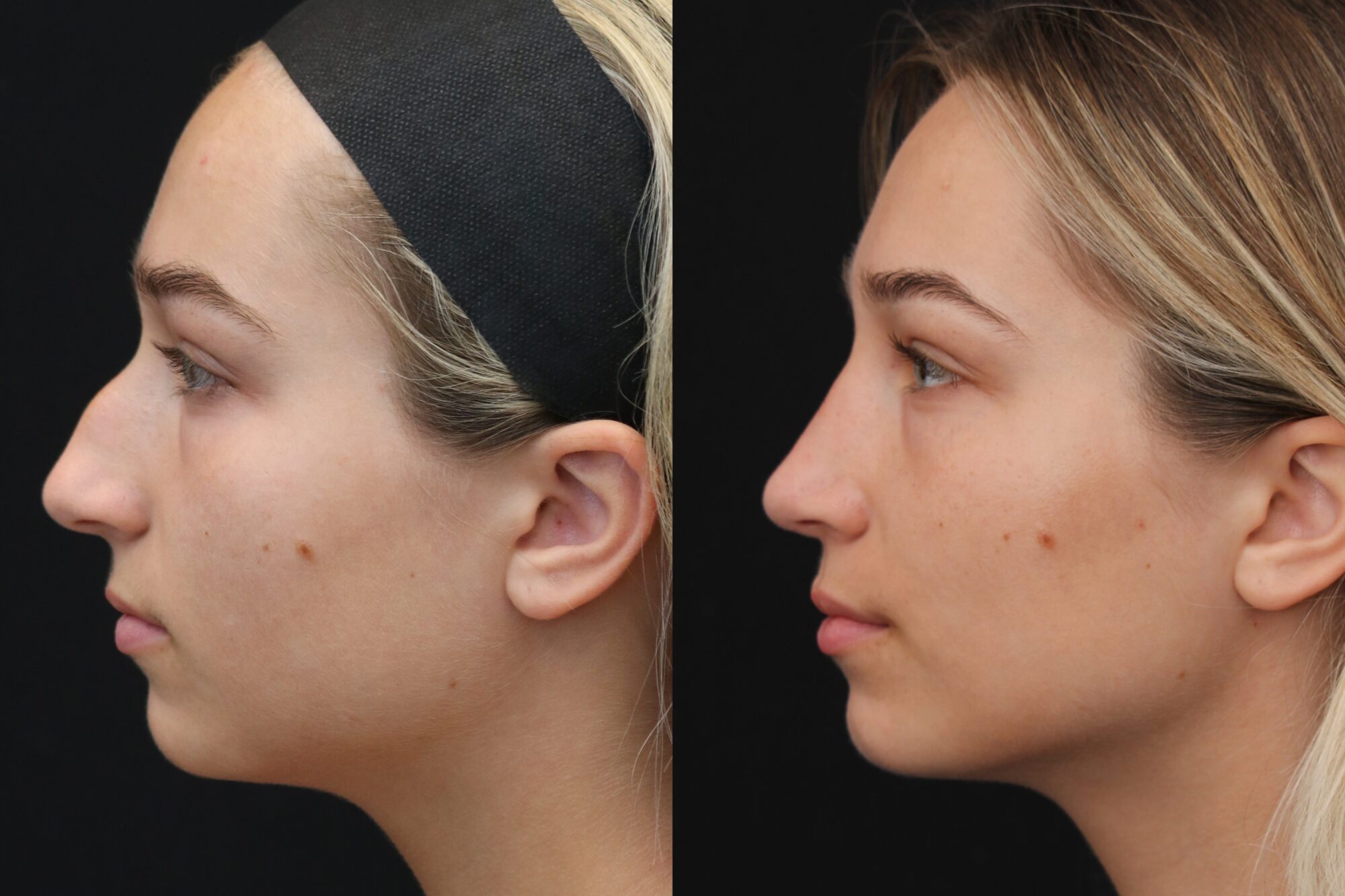 patient and coordinator reviewing plastic surgery cost in Indianapolis