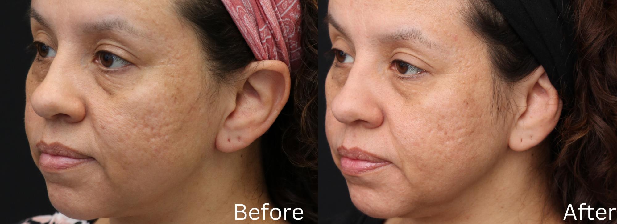 SCAR FACES 新品・未開封 Scar Therapy - Dr. Chernoff Plastic Surgery