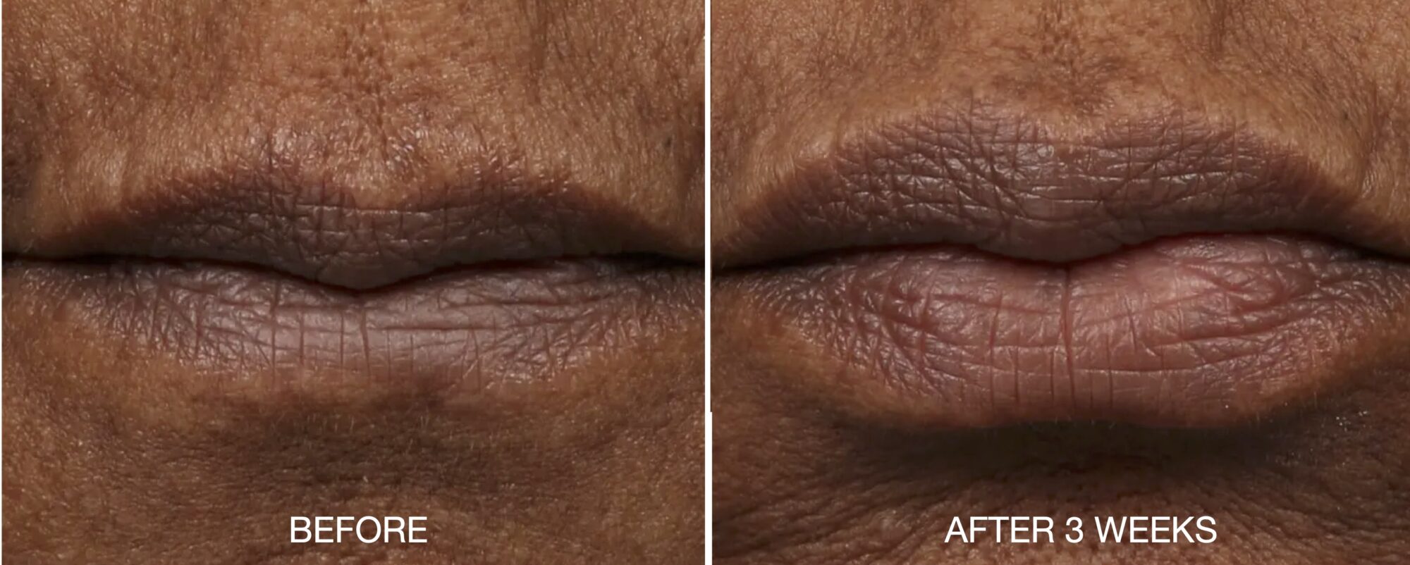 OurSelf_Lips_Chernoff_1-scaled