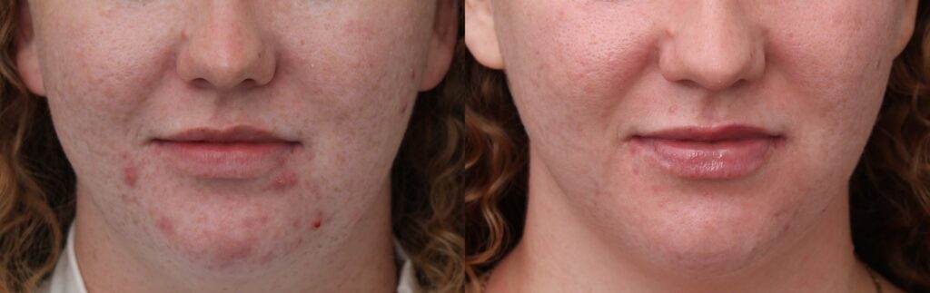 Face Reality Before and Afters - 7