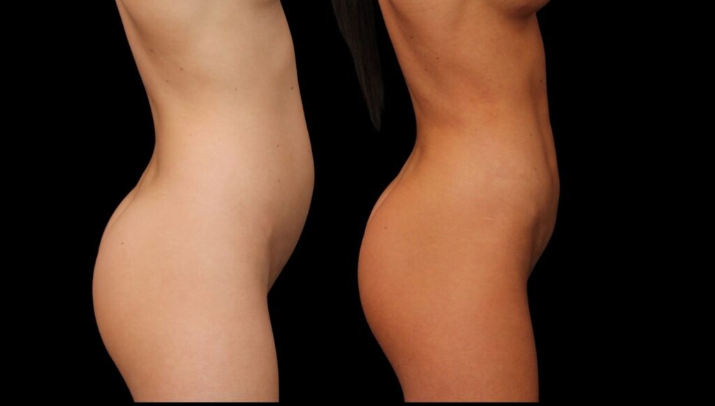 Untitled design (4) copy 2