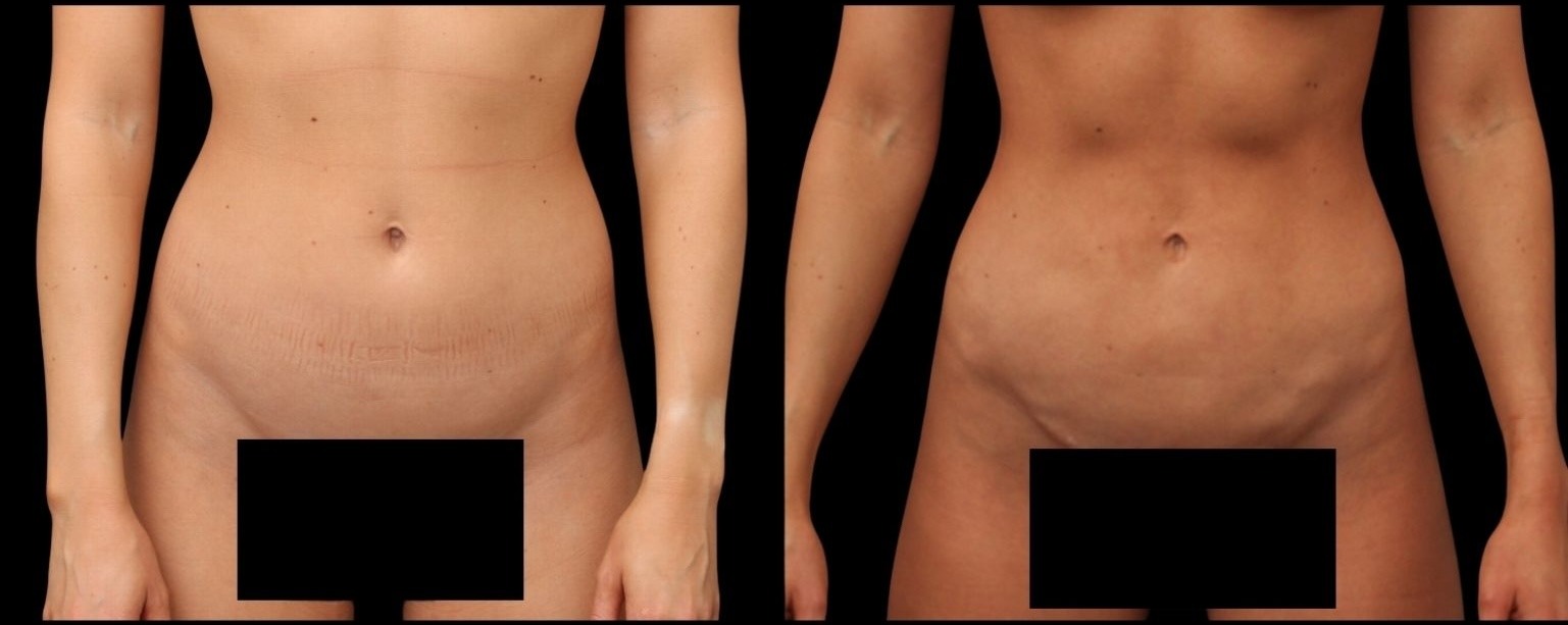 Untitled design (4) copy 3 Untitled design (4) copy 3