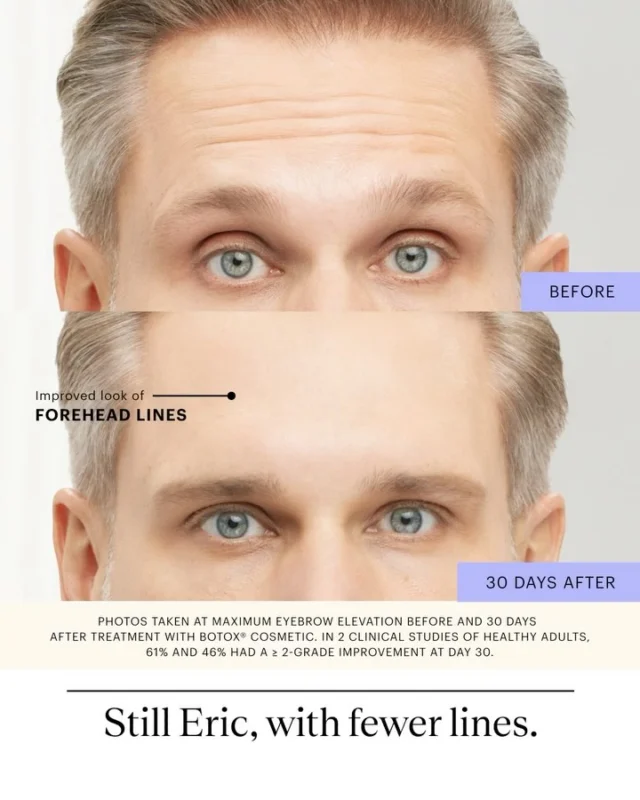 Still Eric, just with fewer lines. Haven’t book a BOTOX® Cosmetic consultation yet? Talk to our licensed specialists to schedule a consultation today! 💉