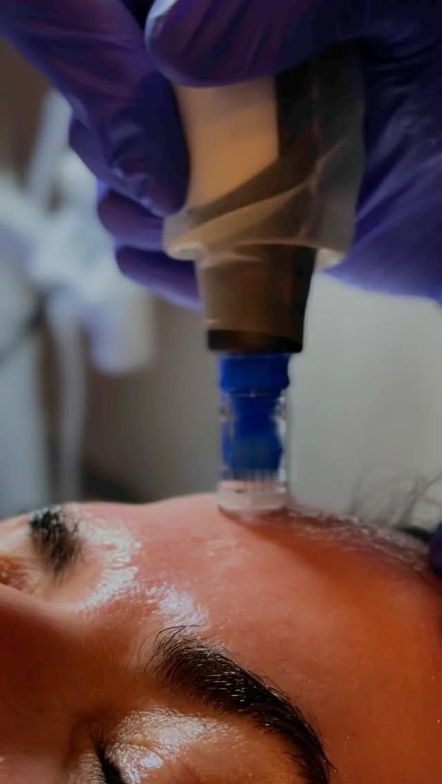 Smooth, tighten, and brighten - all in one treatment! Promote your collagen on your face, neck, and chest today. To schedule your MicroNeedling appointment call us at (317)573-8899! ✨